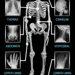 Body/ Home Screen: From this page you may navigate to anythere in the app. This is the page you will start in to find the desired exam. To find PA Chest touch the icon THORAX.